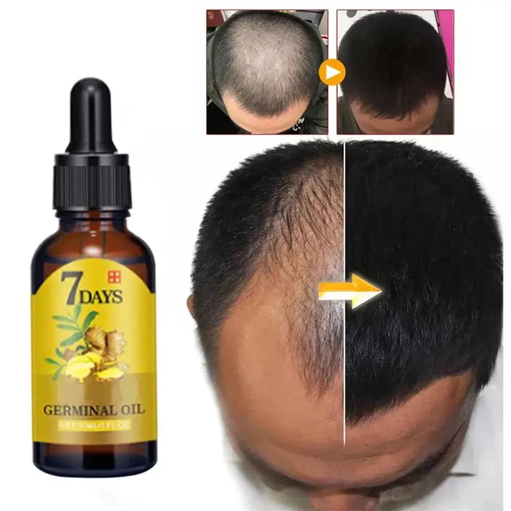 Beard Oil Growth - Имбир для роста волос, эфирное масло