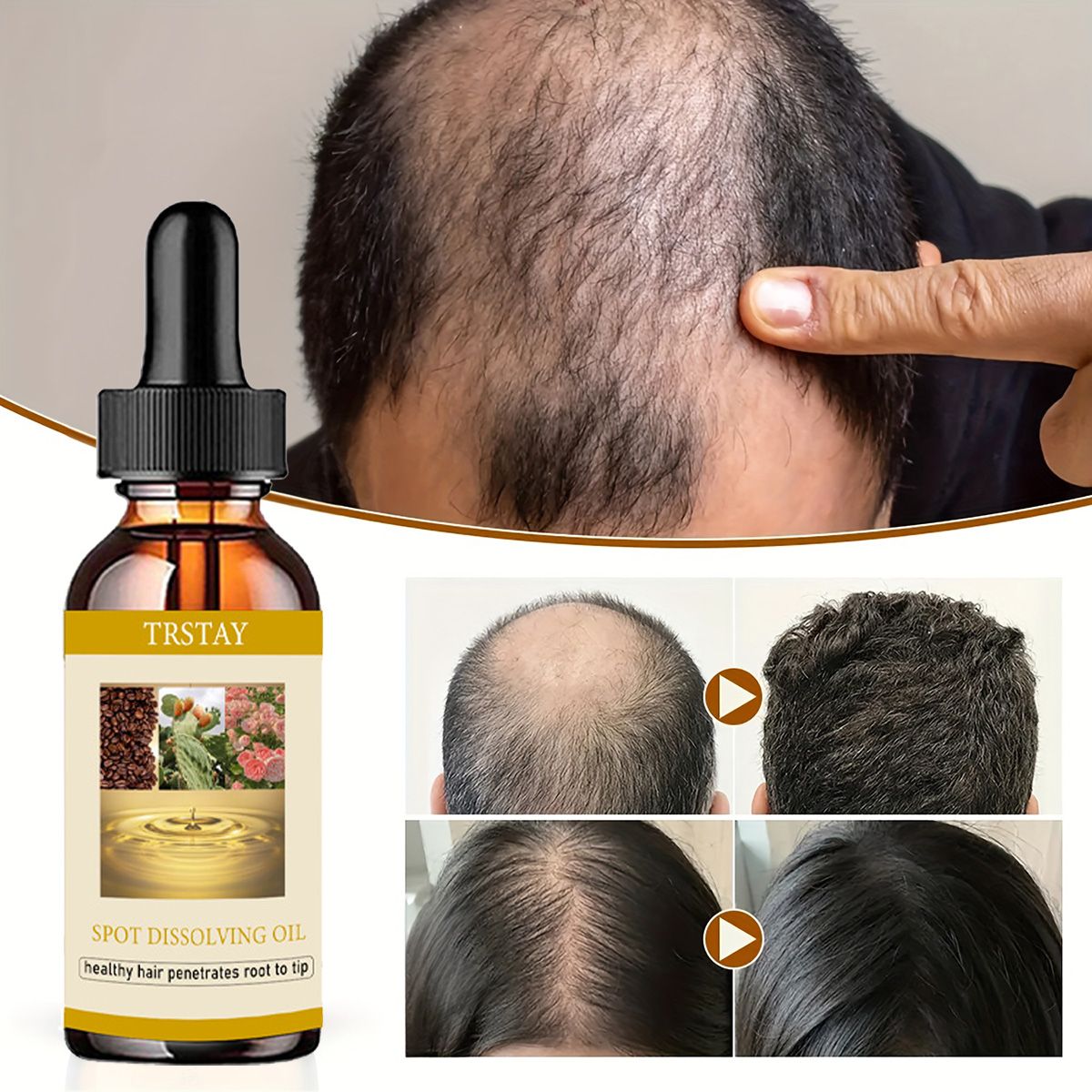 Эфирное масло для роста бороды – обзор и цена Beard Oil Growth