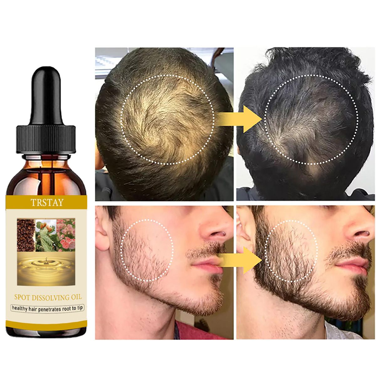 Эфирное масло для роста бороды – обзор и цена Beard Oil Growth
