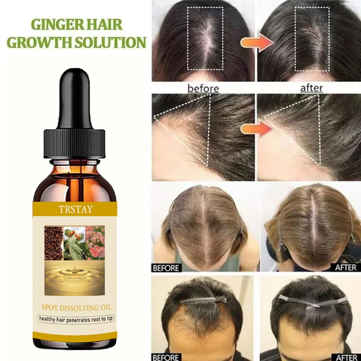 Эфирное масло для роста бороды – обзор и цена Beard Oil Growth