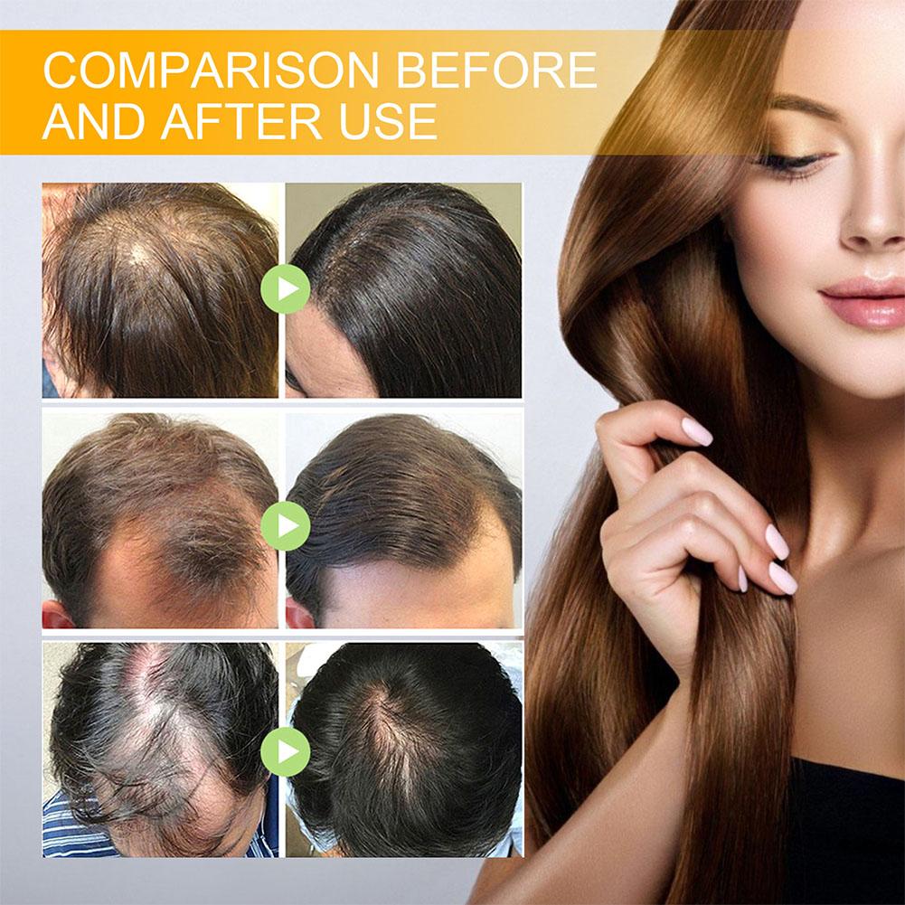5/3/1 шт., средства для быстро – обзор и цена Beard Oil Growth
